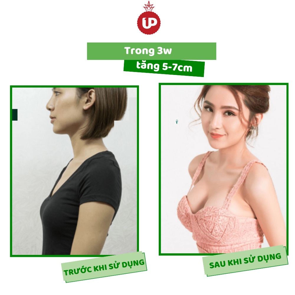 Tăng vòng một an toàn, combo tăng size vòng 1 nhanh ,tăng kích thước vòng một nhanh chóng săn chắc tự nhiên - One Up