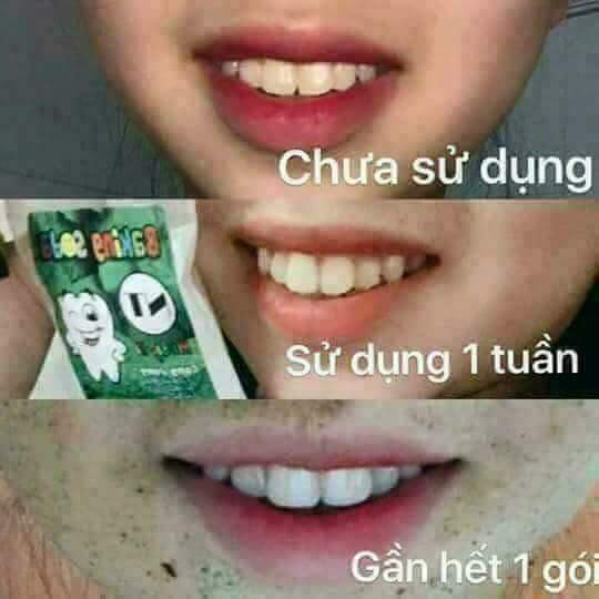 Baking Soda NT mix bạc hà
