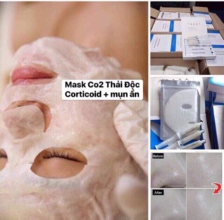 Hộp Mặt Nạ CO2 DJ Carbon Therapy Chuyên Dùng Trong Spa