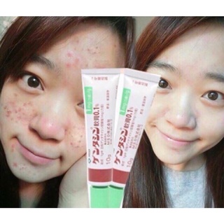Gel mờ thâm sẹo Gentacin Nhật