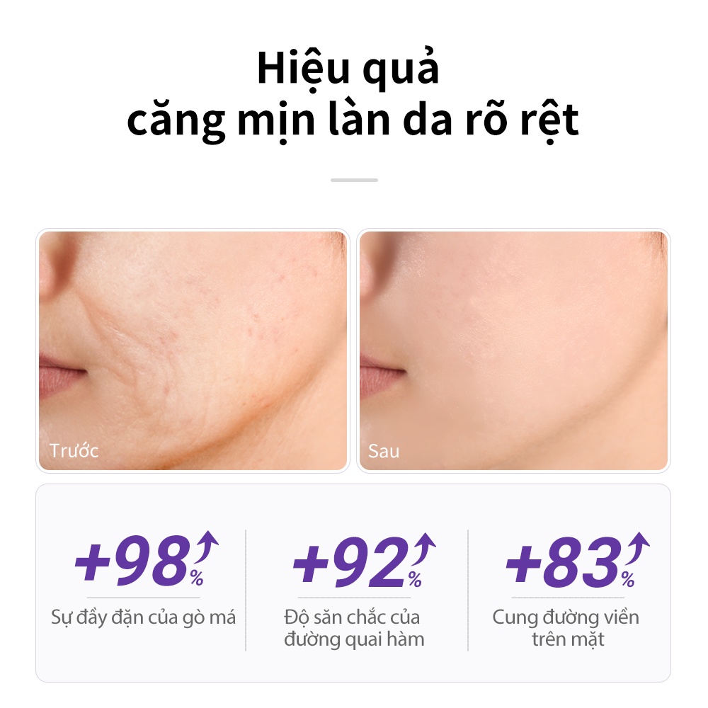 Serum Lanbena Dưỡng Ẩm Chống Lão Hóa Làm Săn Chắc Da 3A Retinol 30ml