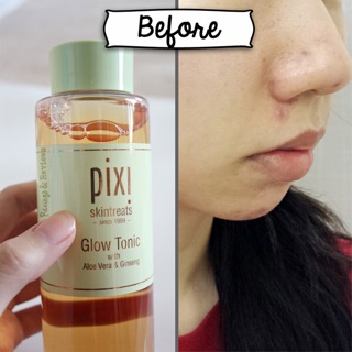Nước cân bằng PIXI glow tonic