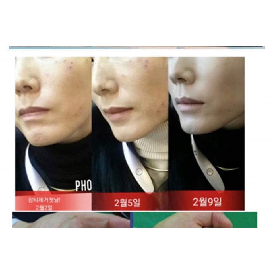 1 ống tế bào gốc CellMico dưỡng da chắc khỏe, căng mịn hỗ trợ điều trị mụn, đầy sẹo | BigBuy360 - bigbuy360.vn