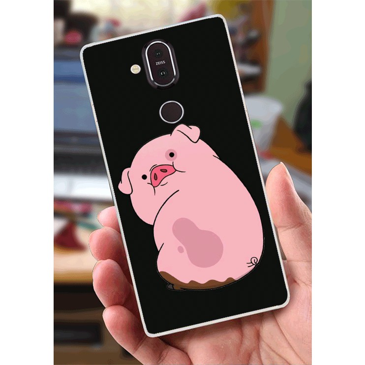 Ốp Lưng Nokia 8.1 (X7) (Dẻo) - Heo Con Mập