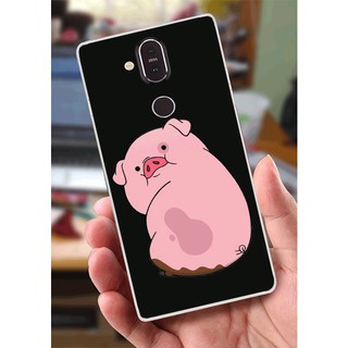 Ốp Lưng Nokia 8.1 (X7) (Dẻo) - Heo Con Mập