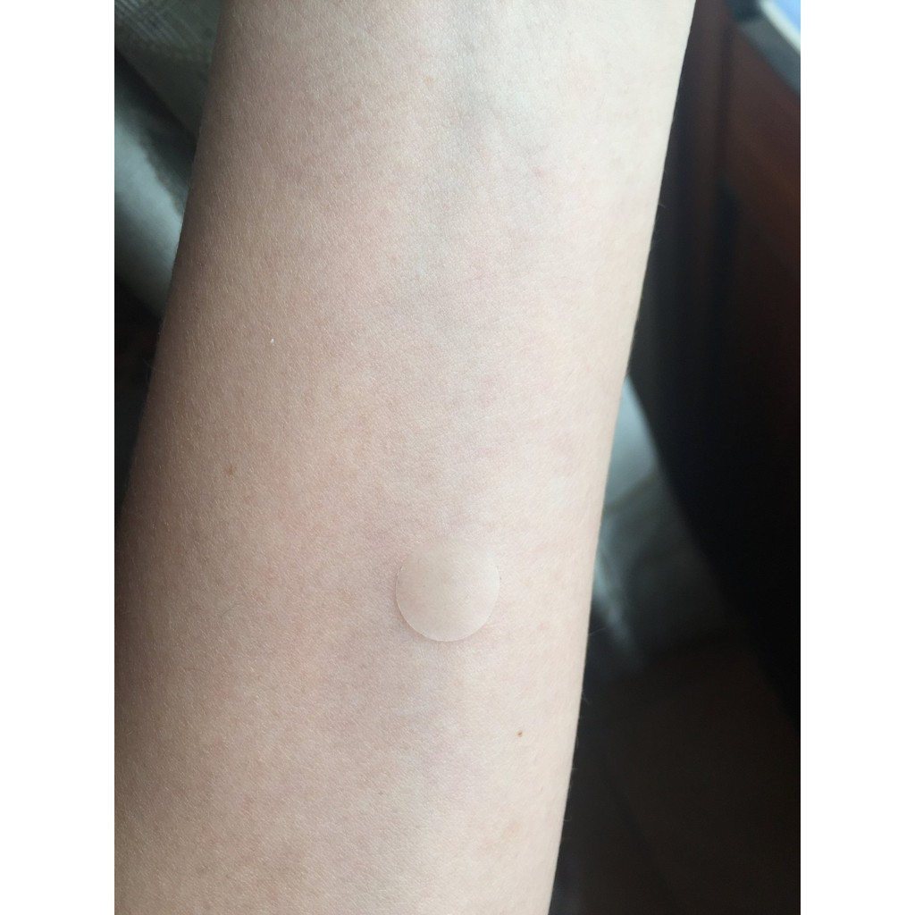 Miếng dán hỗ trợ giảm mụn ACNE PATCH 20dayskin | BigBuy360 - bigbuy360.vn