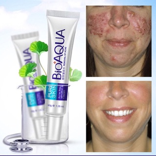 Combo Bộ Mụn 4 món Bioaqua