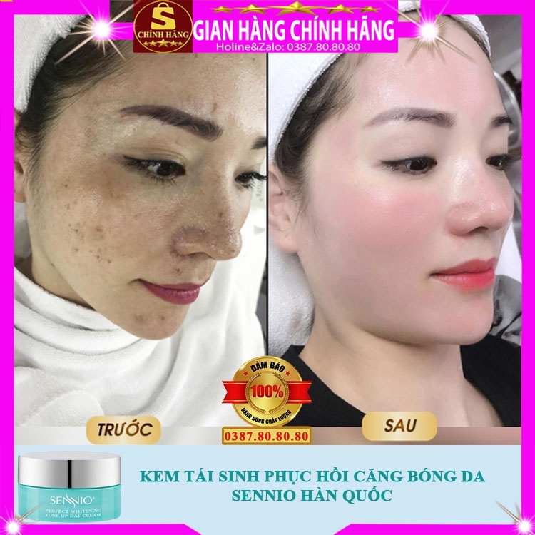 Kem dưỡng trắng căng bóng da mặt Sennio hàn quốc tái sinh phục hồi chống lão hóa da dành cho nam nữ bà bầu ban đêm ngày