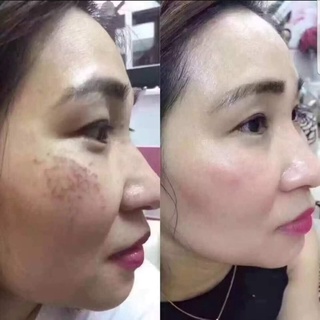 [5ml-50ML ] Thuốc Bắc Tái Tạo Da