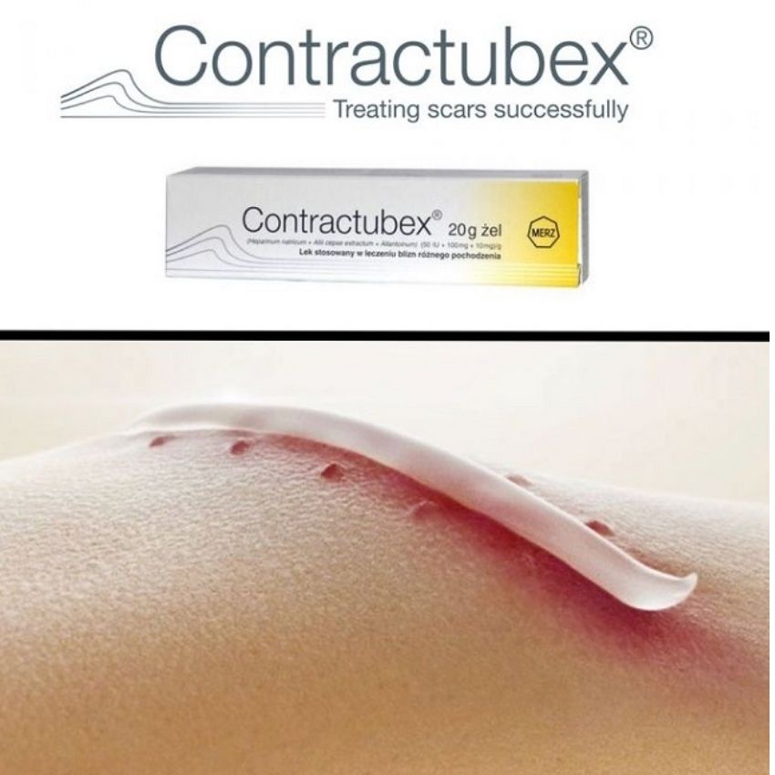 Kem làm mờ sẹo Contractubex, gel bôi sẹo lồi, sẹo lõm nhập khẩu 20g