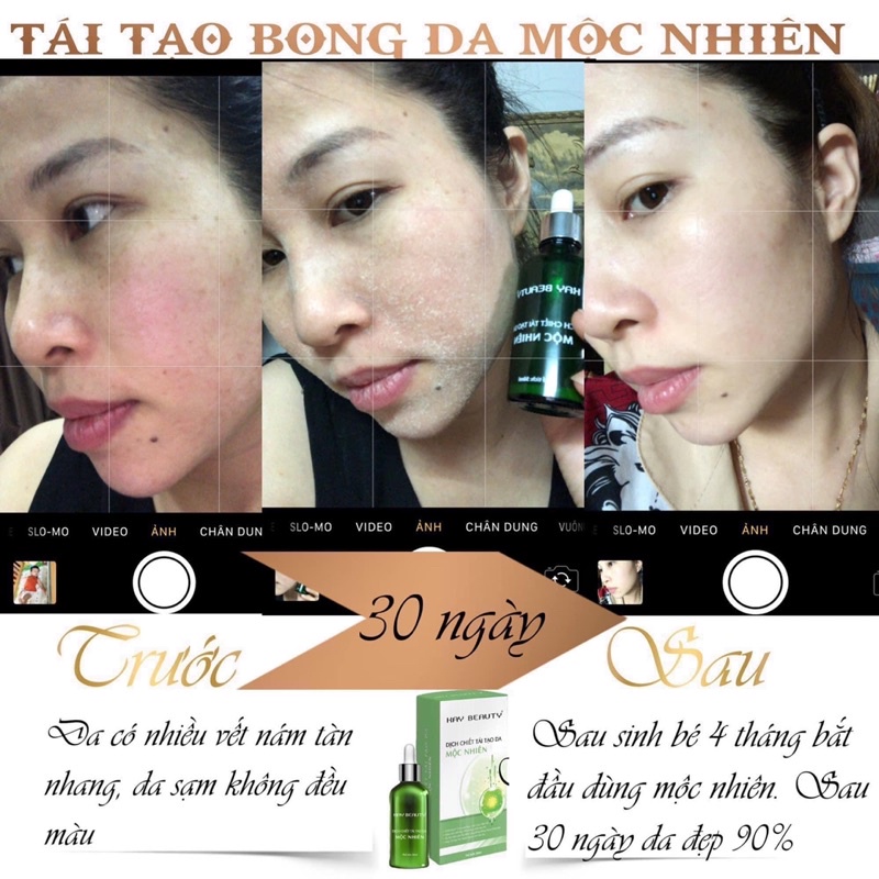 Tái tạo da mộc nhiên đông y (tặng 1 son nhung lì)