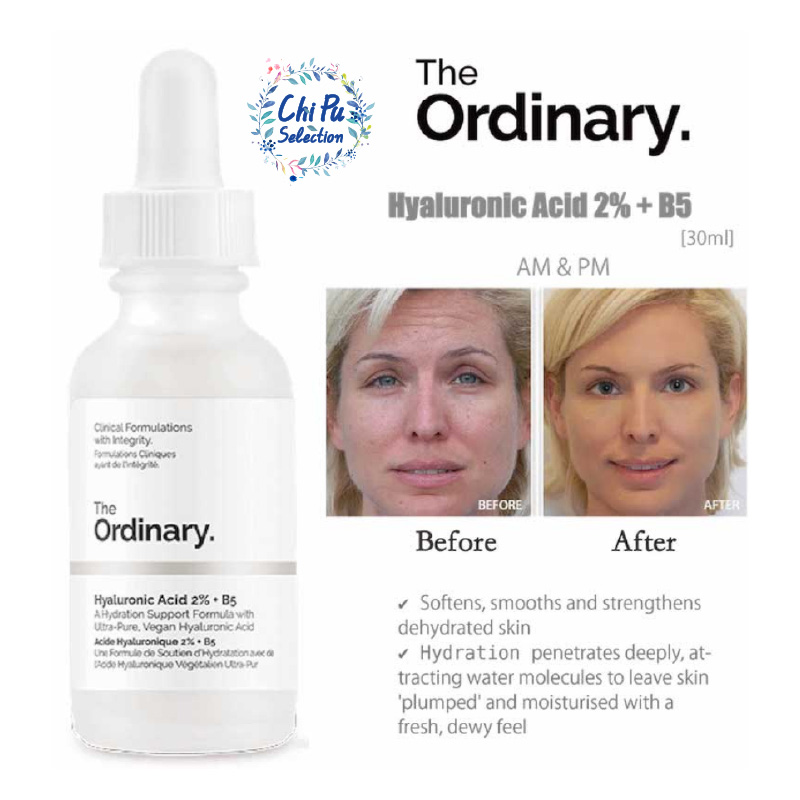 Tinh Chất Cấp Nước Tinh Chất The Ordinary Hyaluronic Acid 2% B5 Serum 30ml