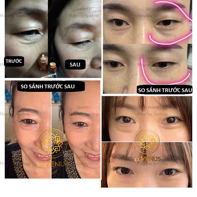 Kem Dưỡng Vùng Mắt zzVENUS Advanced Night Repair Eye Concentrate Matrix [25ml + 15ml + 1ml] | BigBuy360 - bigbuy360.vn