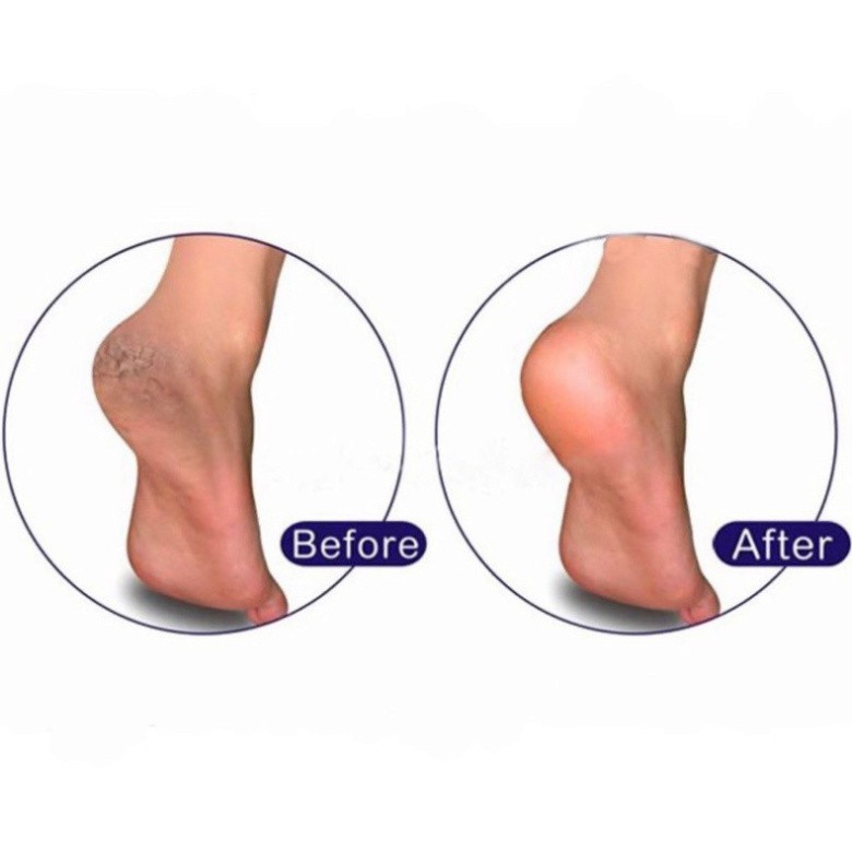Mặt lưỡi chà gót chân thay thế - dụng cụ chà gót chân inox 304 chuyên dụng cho dân làm móng H76