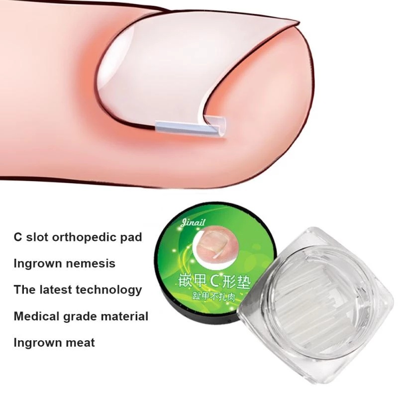 Set 10 Dụng Cụ Chỉnh Sửa Móng Chân / Móng Chân Siêu Mỏng Dùng Một Lần
