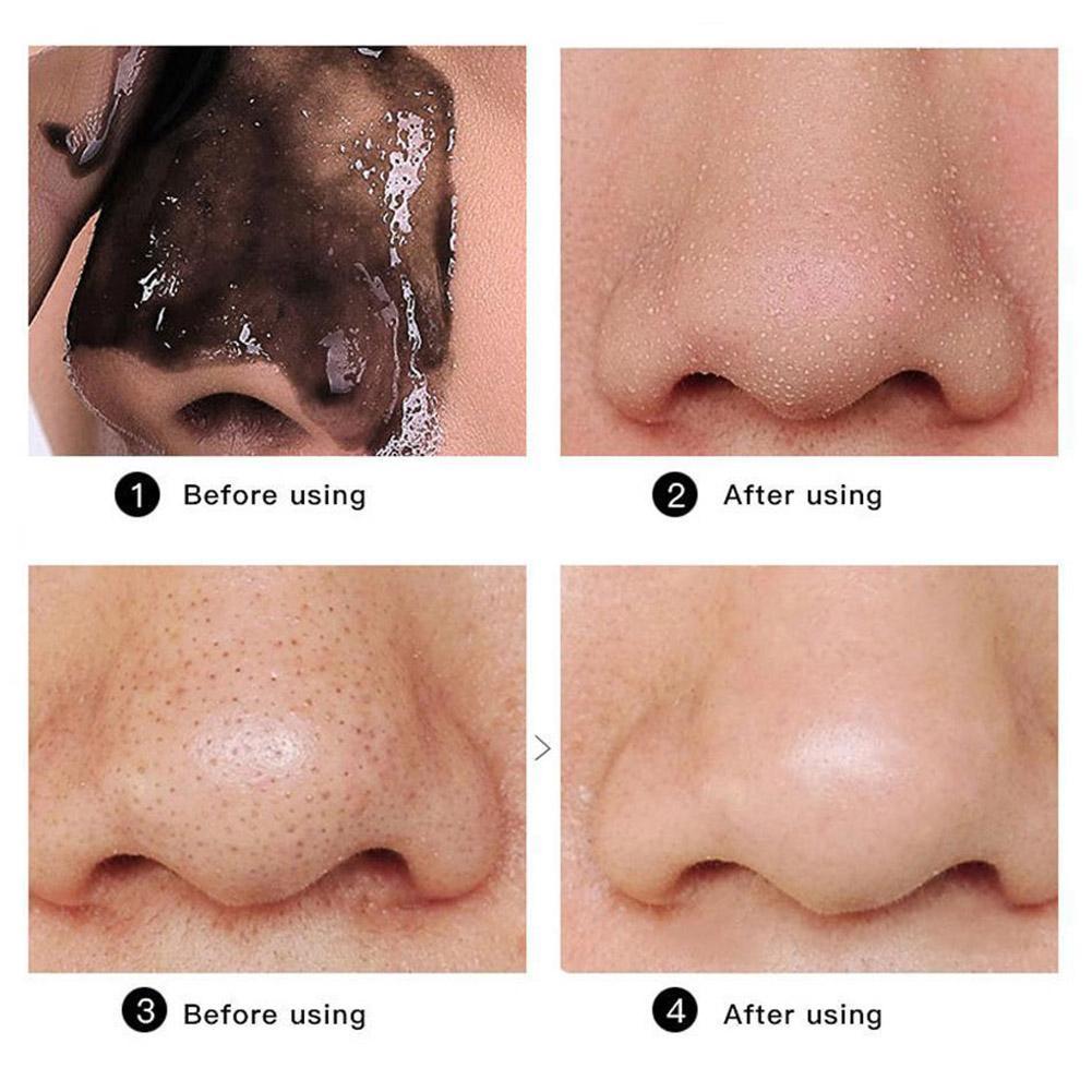 Mặt nạ mỏng lột mụn đầu đen cho mũi 20g mềm mại | BigBuy360 - bigbuy360.vn