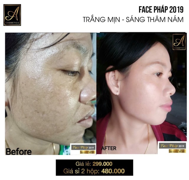 Combo 4 món dành cho da mặt  chữ A