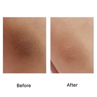 MUỐI TẨY TẾ BÀO VERBENA LINN