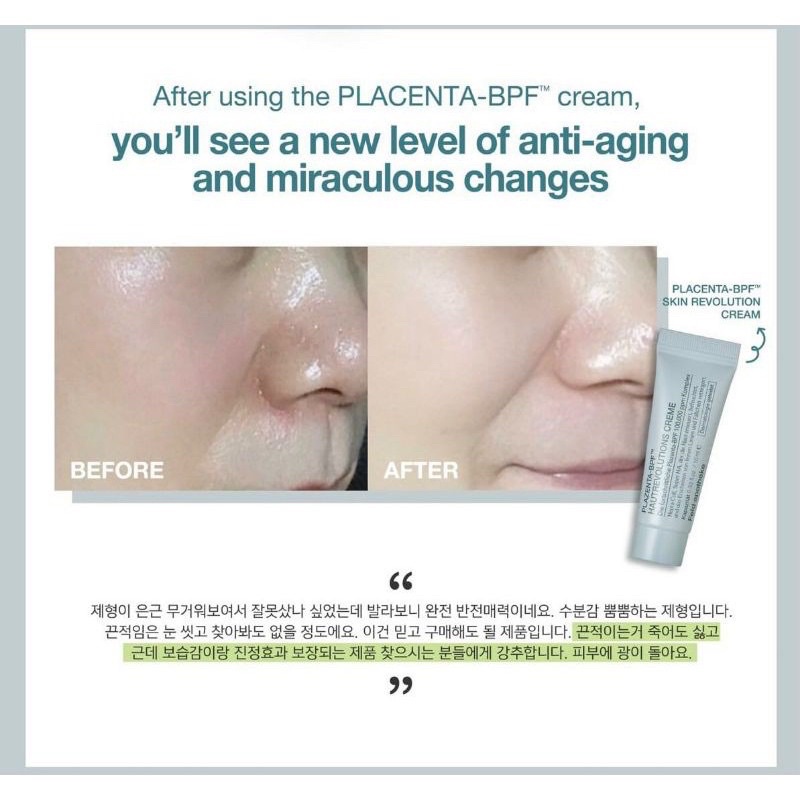 Kem Nhau Thai Phục Hồi Da Plazenta - BPF Skin Revolution Cream Feld Apotheke 10g