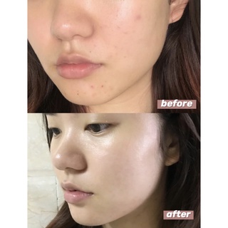 Serum CF 30ml Làm Trắng Và Phục Hồi Làn Da
