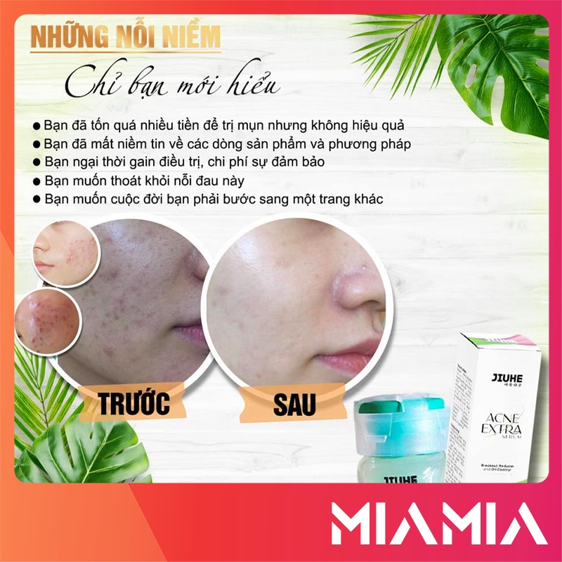 Serum Mụn Jiuhe Acne Extra chính hãng Thanh Tô - Làm sáng vùng da thâm mụn và giảm dầu nhờn