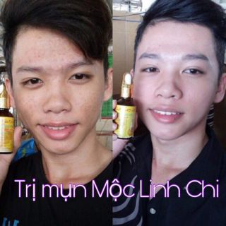 Thảo dược Mộc Linh Chi