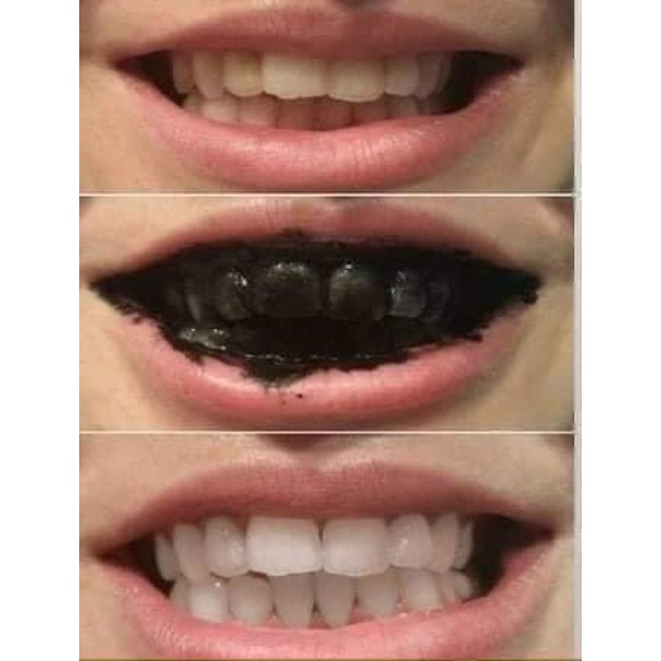 BỘT LÀM TRẮNG RĂNG - LAUGH POWDER