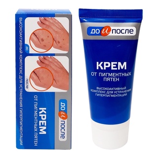 Kem tay đồi mồi Kpem