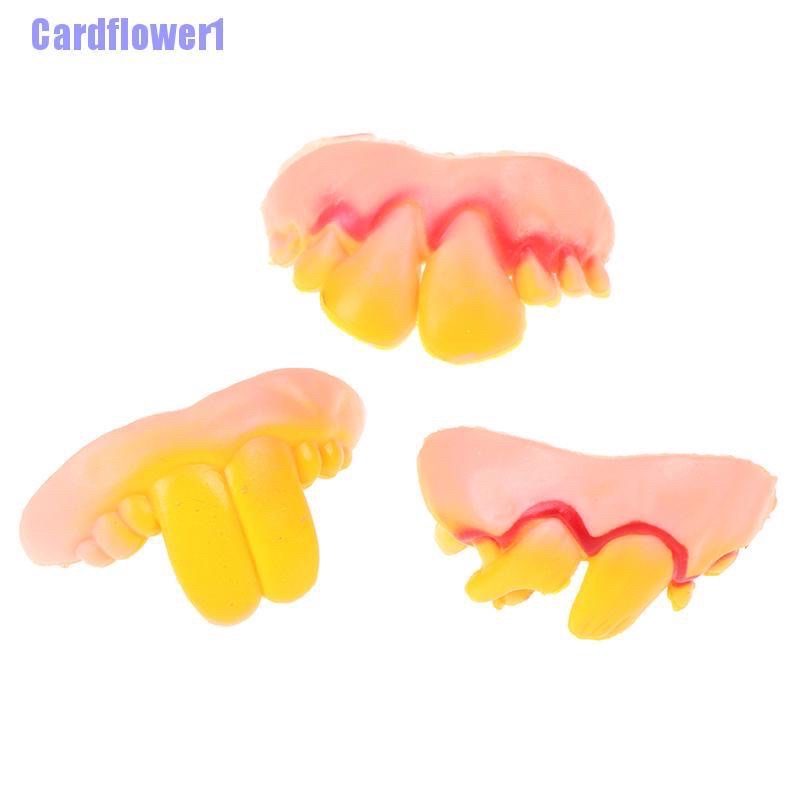 10 Hàm Răng Giả Đẹp