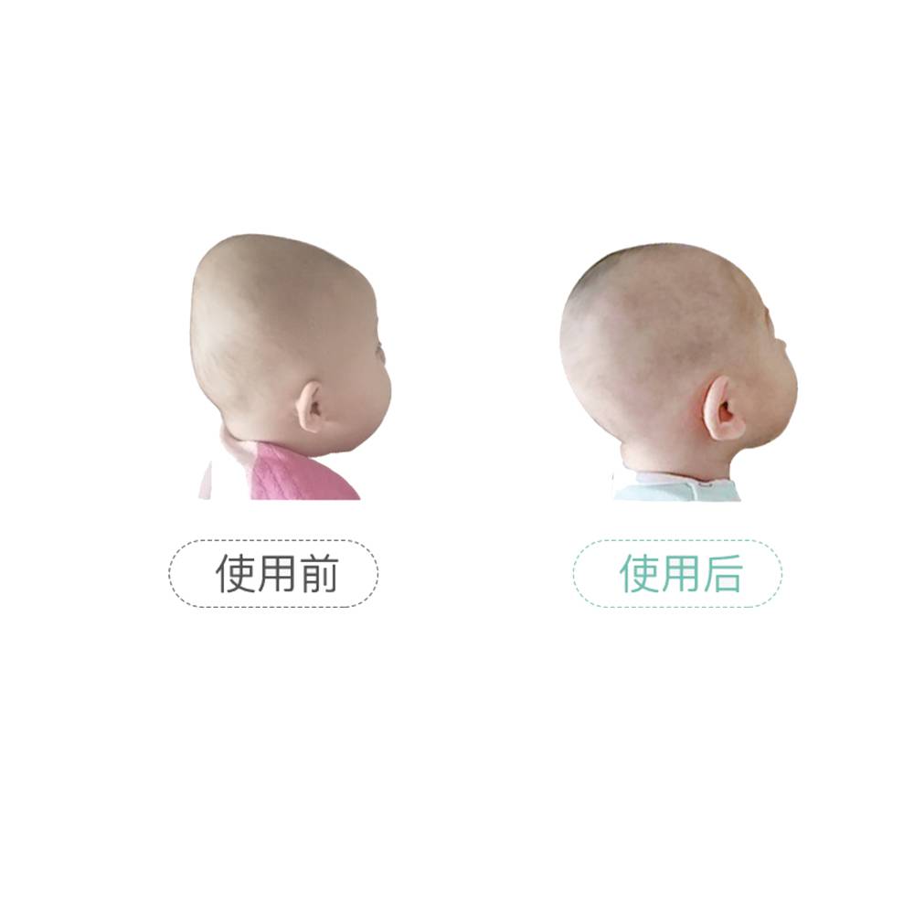 Spot Baby Shape Gối Chống Polar Gối tạo tác Mùa hè Thở sơ sinh Tiểu trẻ sơ sinh Orthosis Baby Corrected Migraine 4D Ring ôm