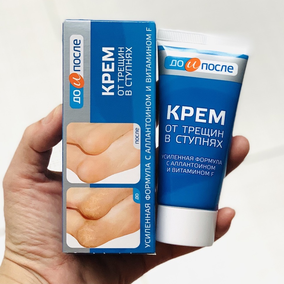 Kem Giảm Nứt Gót Chân Kpem Nga - 50ml