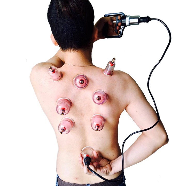 Bộ Giác Hơi Không Dùng Lửa Duy thành loại C - 15 Ly Hộp Giấy Tặng kèm dây tự giác