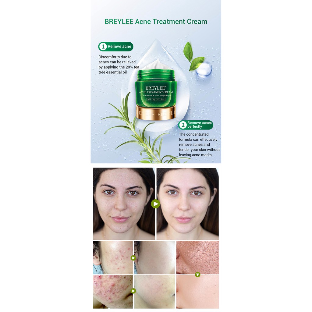 Kem Hỗ Trợ Giảm Pimples Breylee Kiềm Dầu Thu Nhỏ Lỗ Chân Lông 20g / 0.71 floz | BigBuy360 - bigbuy360.vn