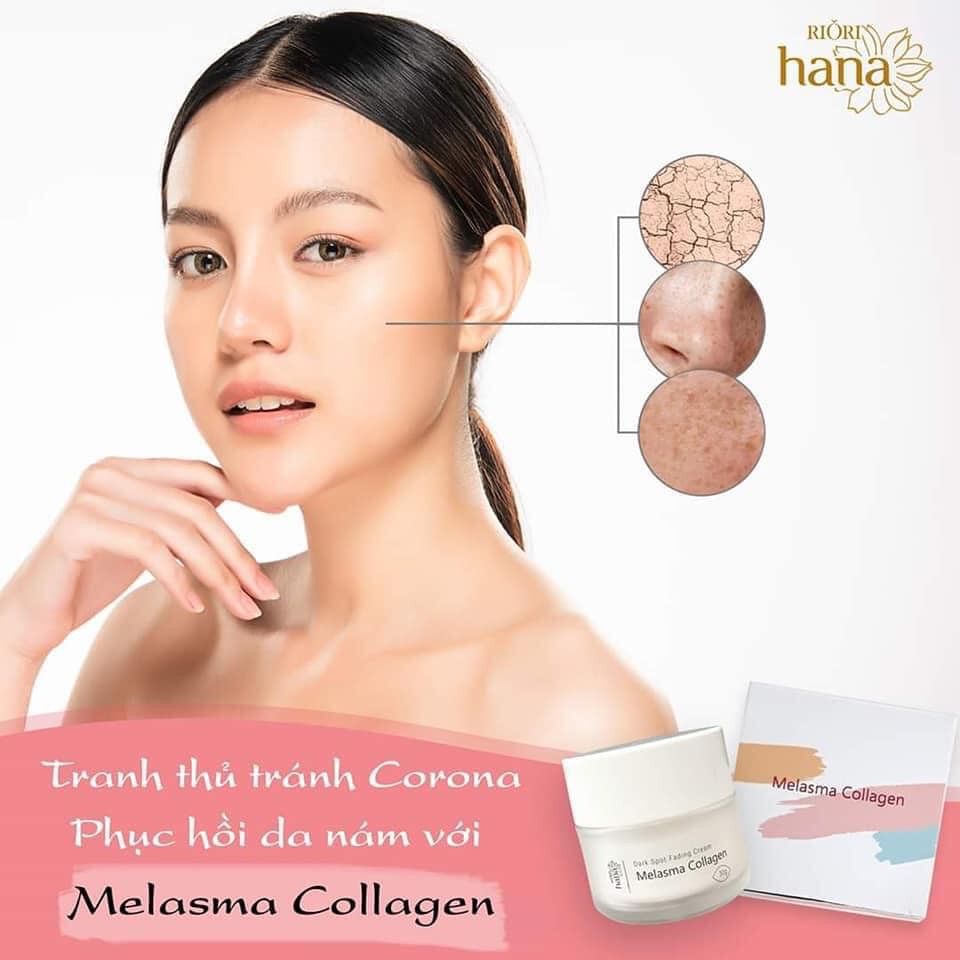 Kem Dưỡng Da Nám Riori Hana Melasma Collagen Cream 30g - Mờ Nám Thâm Sạm Ngăn Ngừa Lão Hóa