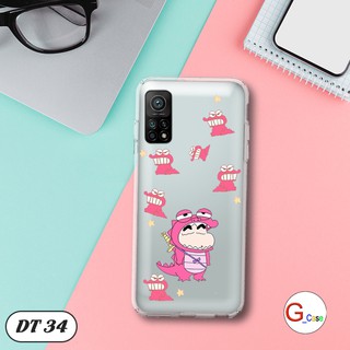 Ốp lưng dẻo cho Xiaomi Mi 10T Pro
