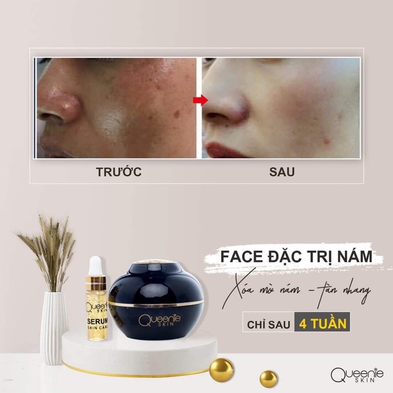 KEM FACE DÀNH CHO DA NÁM  TÀN NHANG CHÍNH HÃNG QUEENIE SKIN MẪU MỚI 50gram