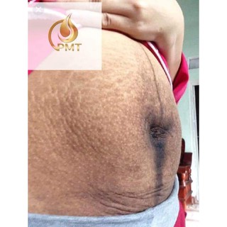 SERUM MỜ THÂM ĐA NĂNG PHÚC MINH TÂM [Chuẩn Hàng công ty]
