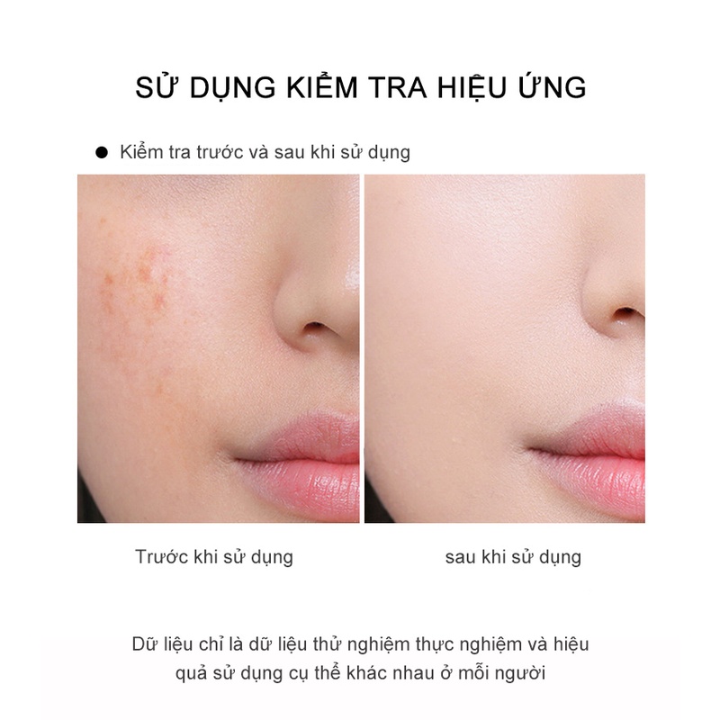 Gel Sạch mụn thương hiệu nhập khẩu 20G,Đối với da bị mụn, khử trùng và loại bỏ mụn,Làm sáng da mặt CYCY-MS-1