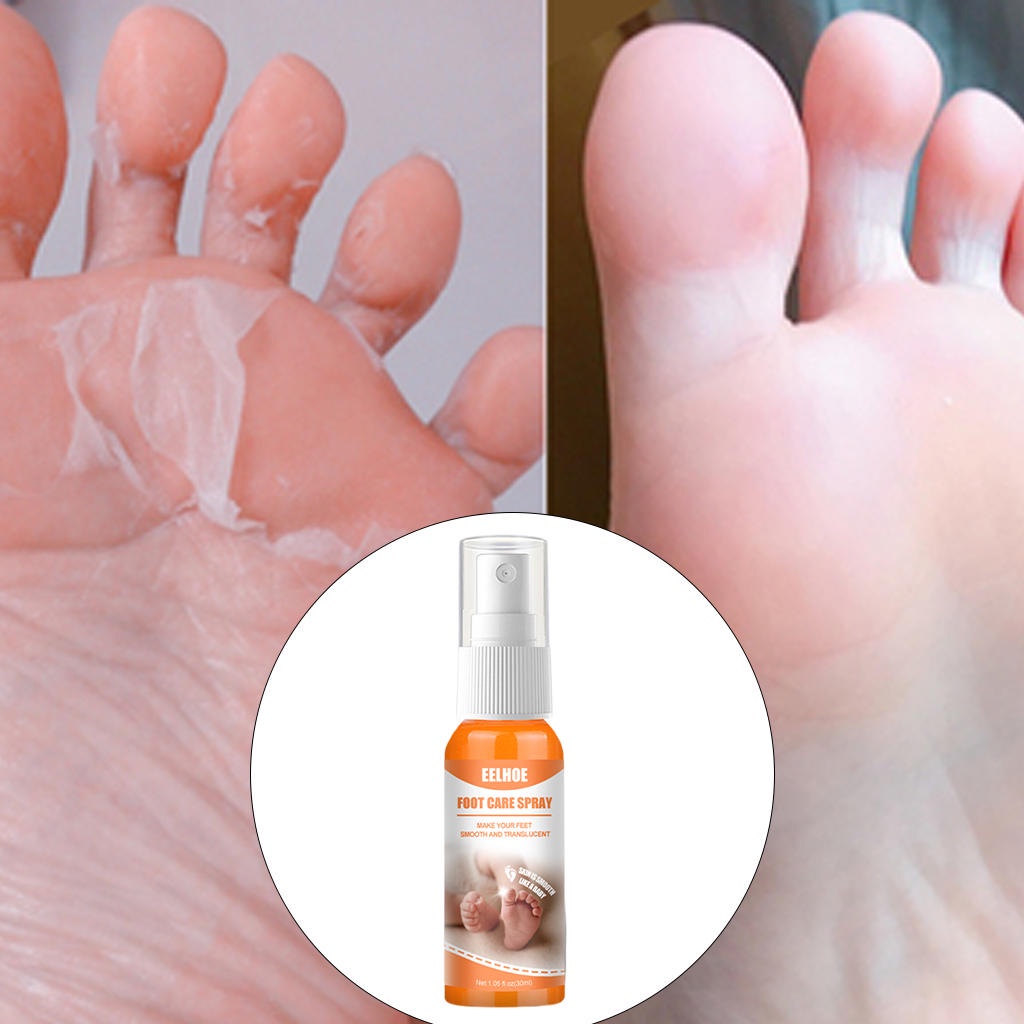 Bình xịt loại bỏ da chết cứng dưỡng ẩm cho da chân