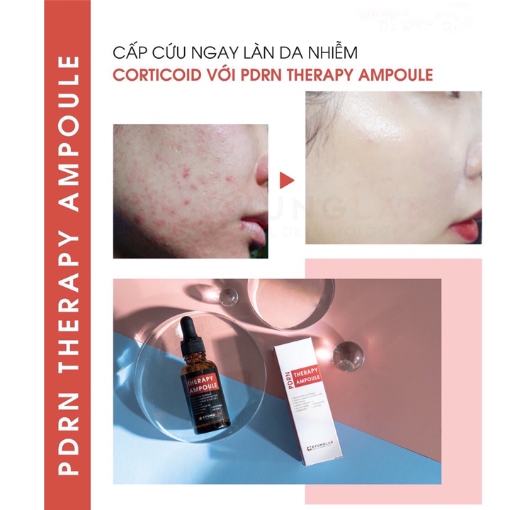 Serum tế bào gốc trắng da Kyung Lab Pdrn Therapy Ampoule 30ml Hàn Quốc Mit Beauty phục hồi da chống lão hóa
