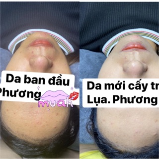 Cấy trắng spa handmade
