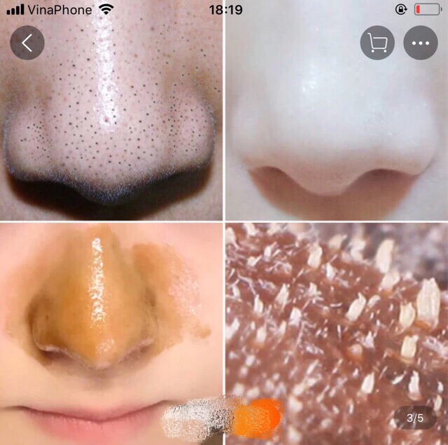 Mặt nạ peel hút mụn đầu đen Bisutang hút mụn ẩn làm sạch bụi bẩn giúp da mịn màng sáng bóng