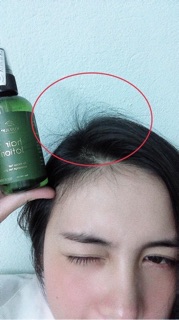 Sịt mọc tóc tinh dầu bưởi vijuly