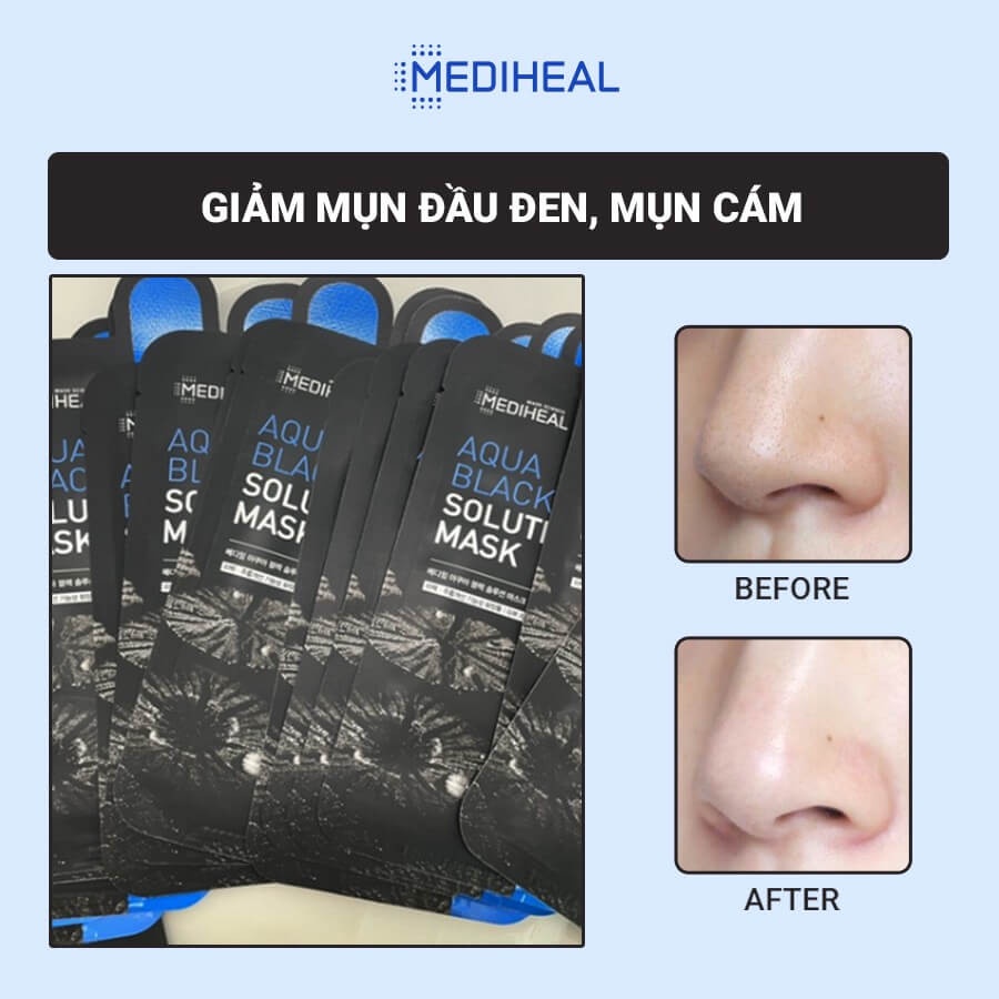 Combo 10 Mặt Nạ Than Hoạt Tính Loại Bỏ Bã Nhờn, Giảm Mụn Đầu Đen, Mụn Cám Mediheal Solution Mask 23ml x 10 - Aqua Black
