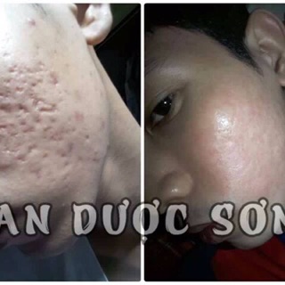 an dược sơn 50ml và bột rửa mặt