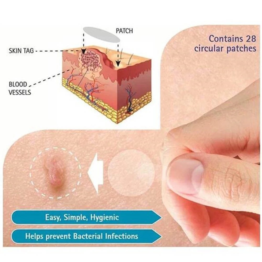 Set 36 Miếng Dán Hỗ Trợ Giảm Mụn Hydrocolloid Vô Hình Tiện Dụng