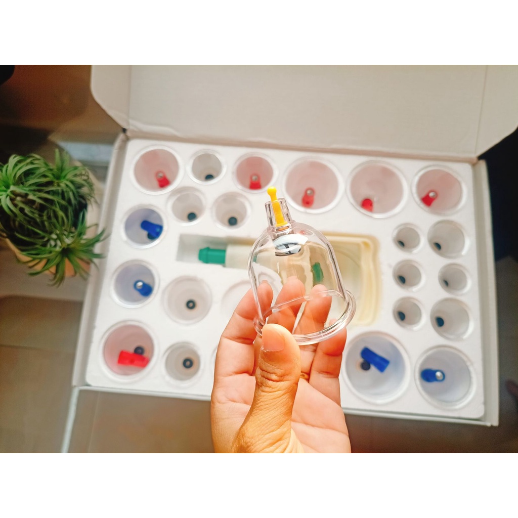 Bộ giác hơi chân không 24 ống đủ phụ kiện