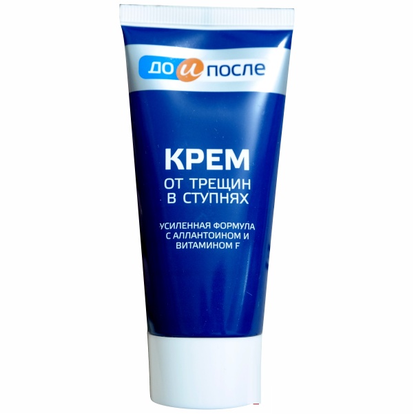 Kem Ngăn Ngừa Và Hồi Phục Nứt Nẻ Gót Chân Kpem Nga 50ml