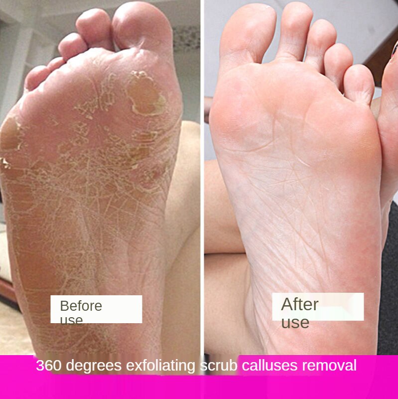 Dụng Cụ Chà Gót Chân Tẩy Tế Bào Chết Bằng Thép Không Gỉ Chuyên Nghiệp Cho Chân Ướt / Khô