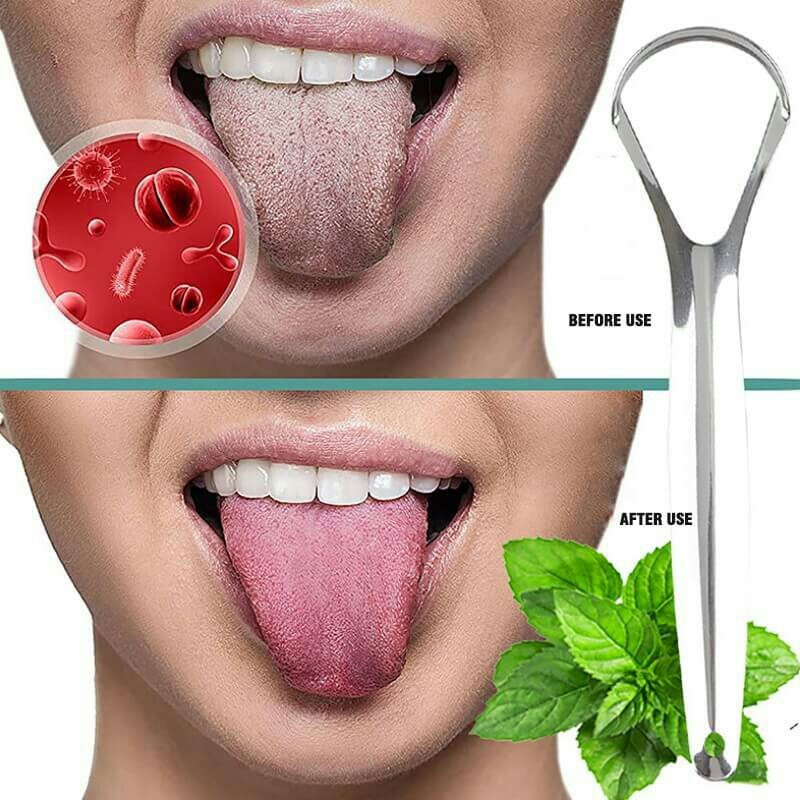 Cạo lưỡi inox kèm hộp đựng cao cấp dụng cụ cạo lưỡi chăm sóc sức khỏe răng miệng loại bỏ vi khuẩn hôi miệng tăng vị giác